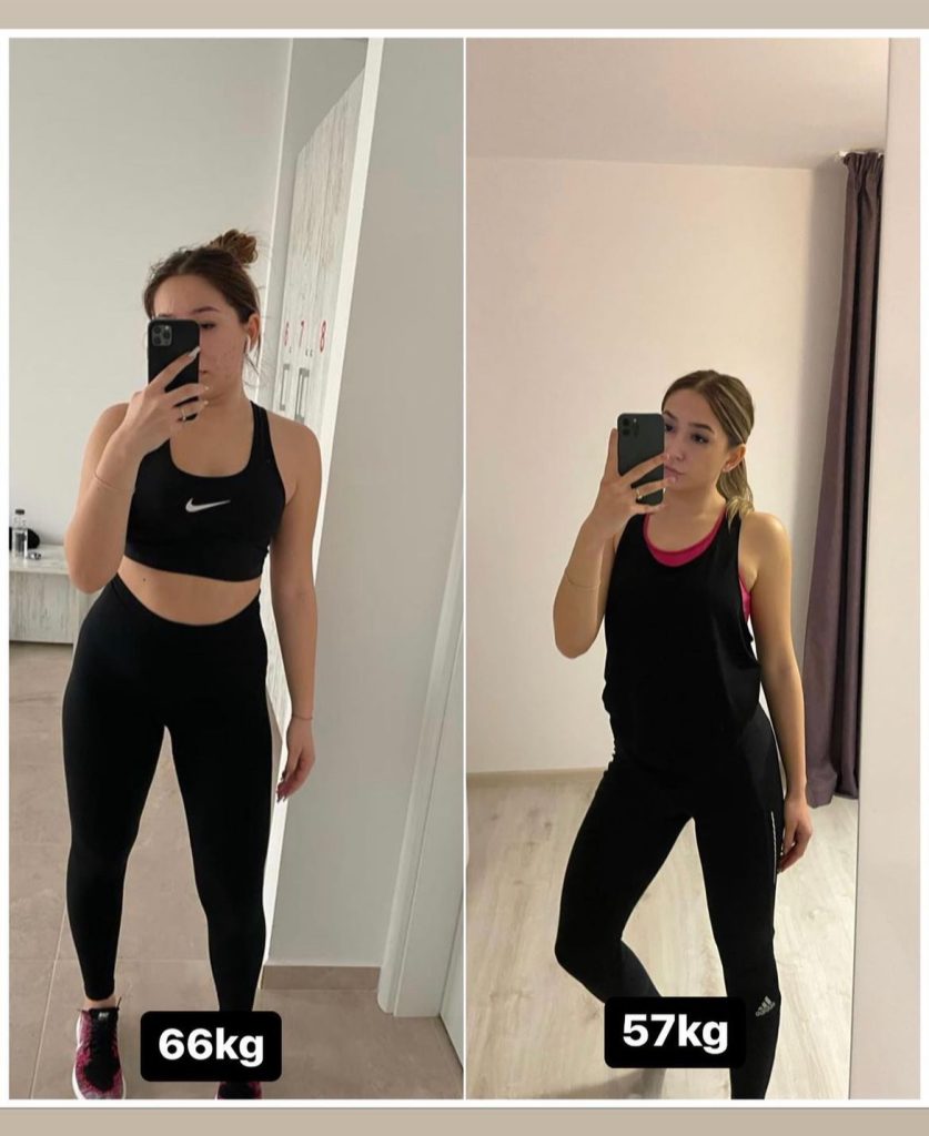 Alexia Before After