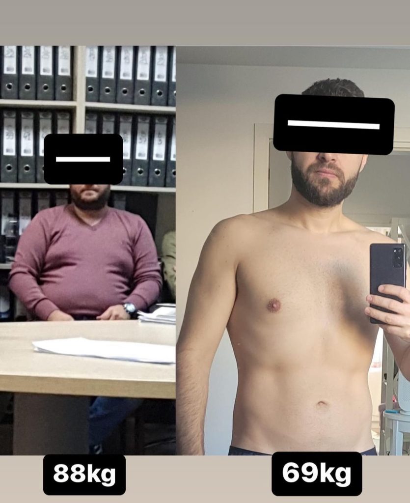 Adinel Before After
